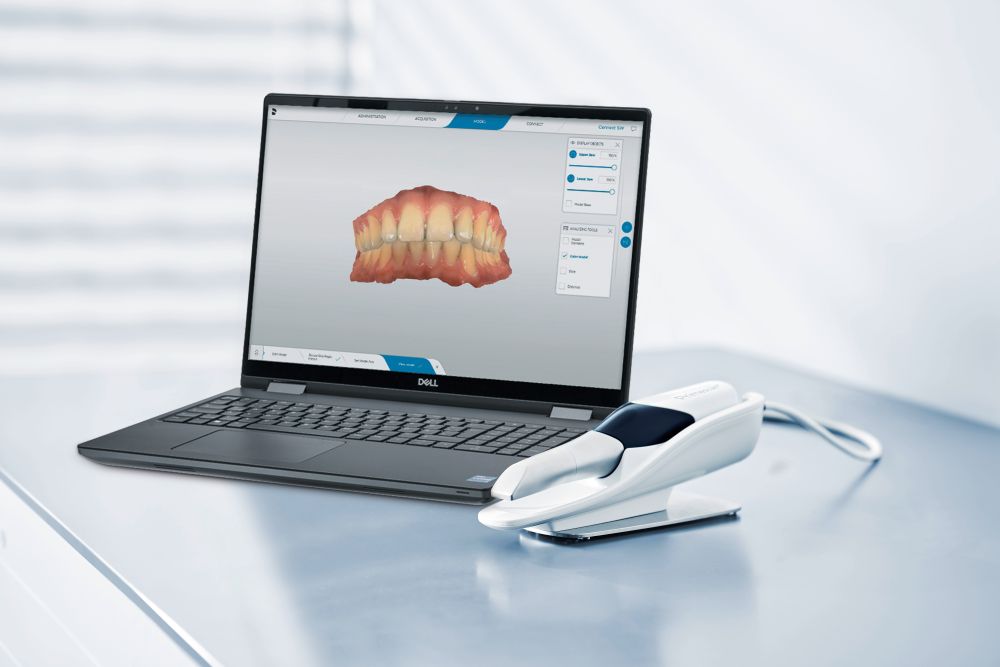 Intraoralscanner