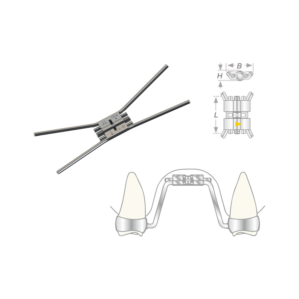 Vector 600 Gaumennahtschraube, 10 Stück