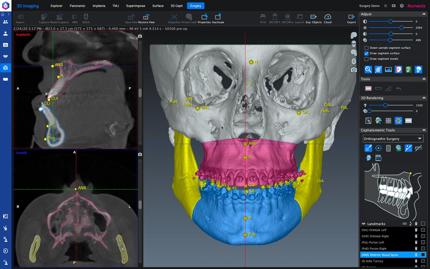 KaVo ProXam 3DQ CMF Surgery Modul background