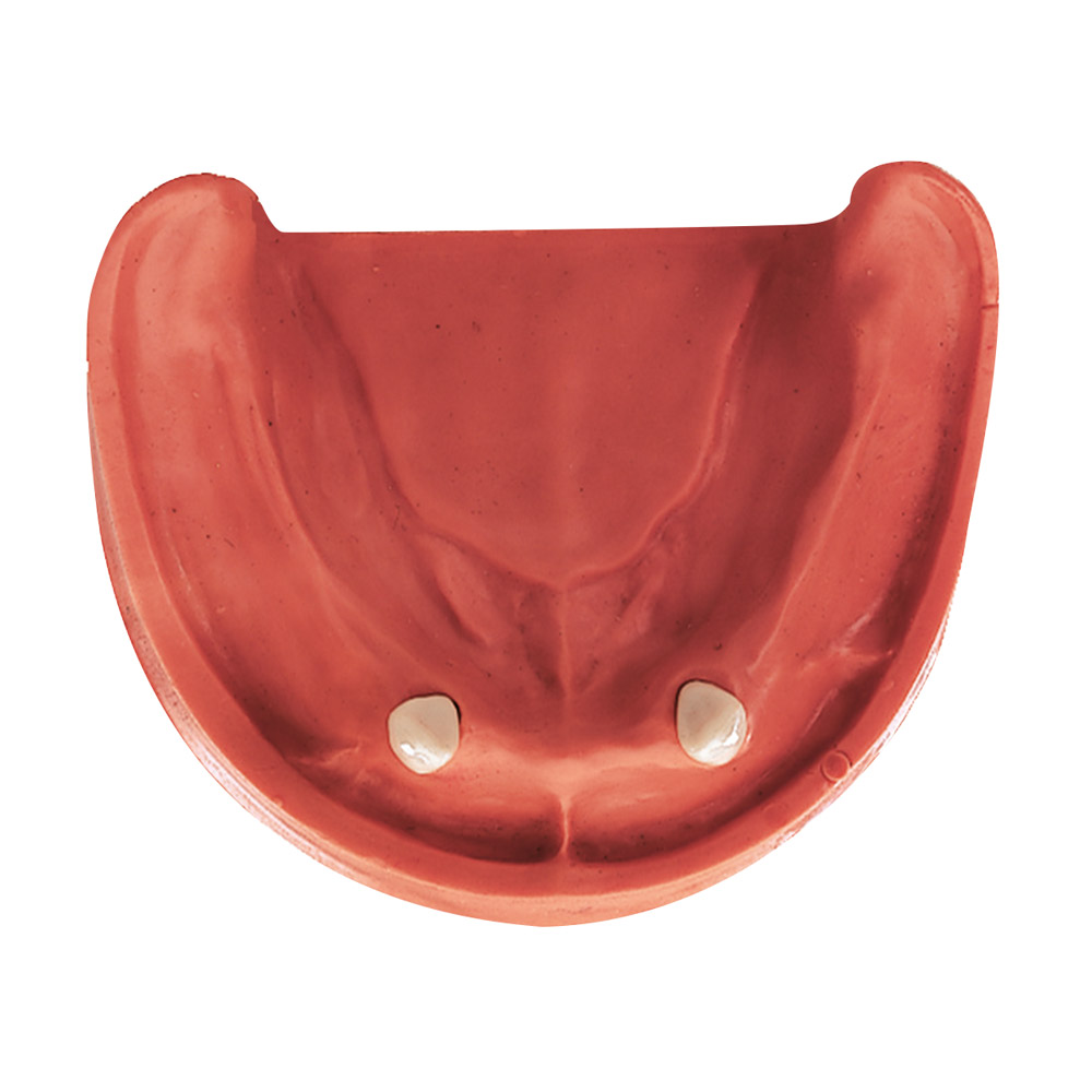 Gingiva Modell UK TZ 2N, Stück