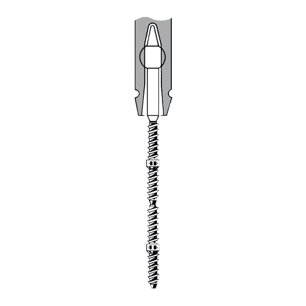 TMS Link plus Doppelstifte Minim Titan 0,525 mm silber, 60 Stück