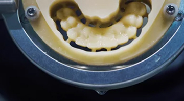 CAD/CAM: Die Zukunft der Zahnmedizin?