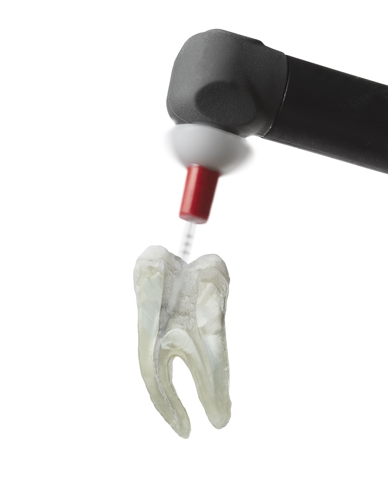 SmartLite Pro EndoActivator