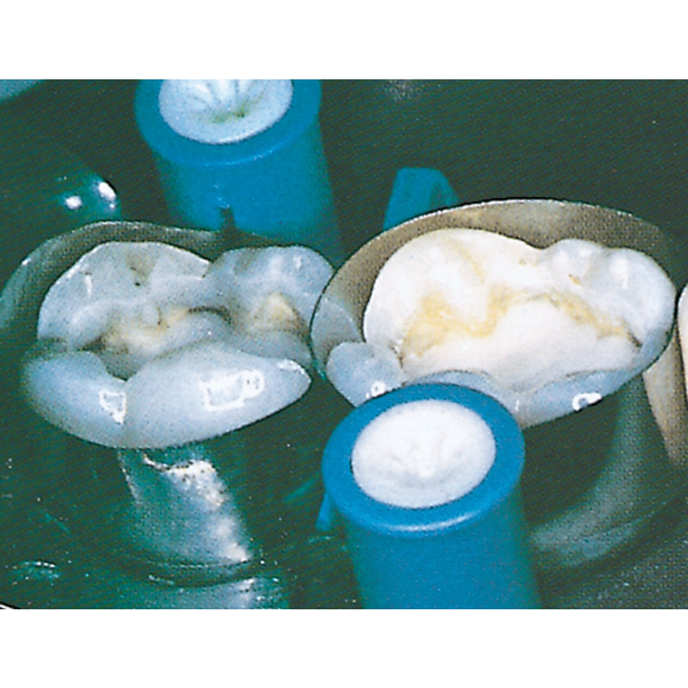 Super-Cap Spulen 6,7 mm, 500 Stück