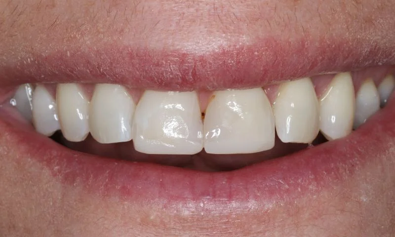 Überprüfung der gewählten Farbe.