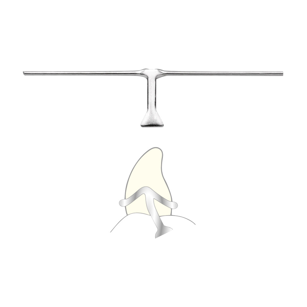 Klammerkreuze OK 0,80 mm, 10 Stück