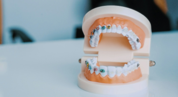 Was ästhetische Zahnmedizin ausmacht