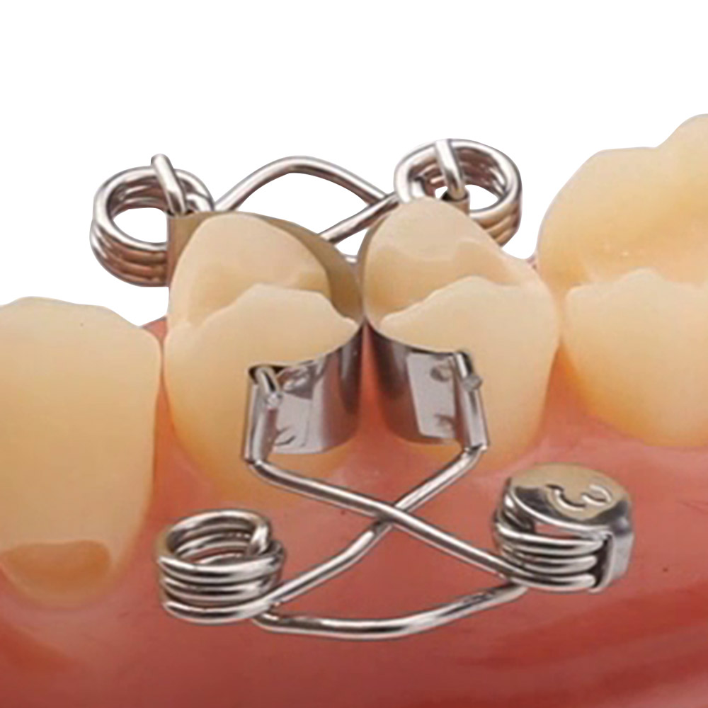 Walser Matrizen 2 X-Form, 5 Stück