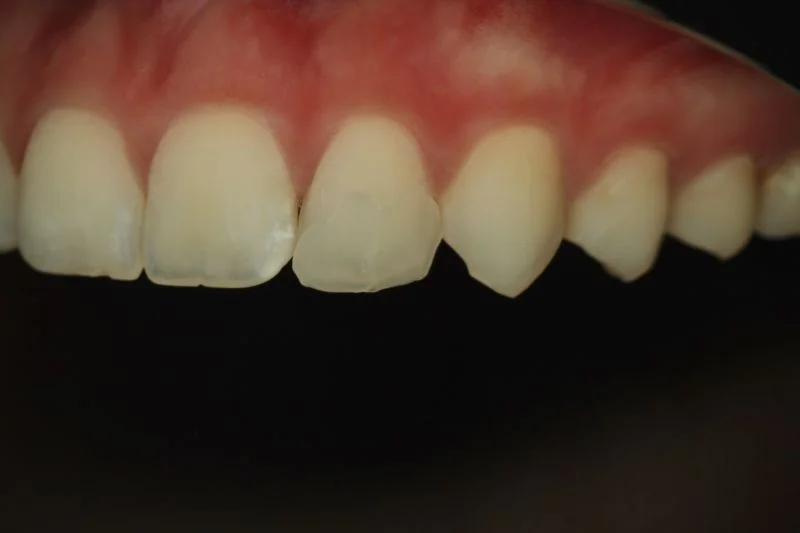 Farbbestimmung des Komposits.