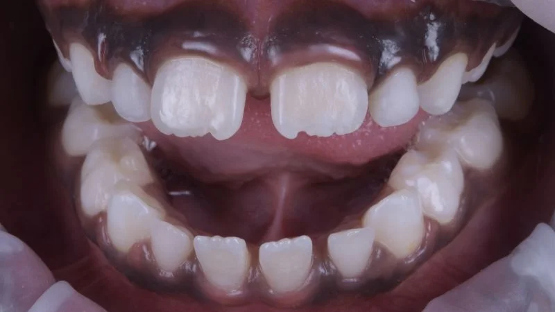 Ausgangssituation des Patienten