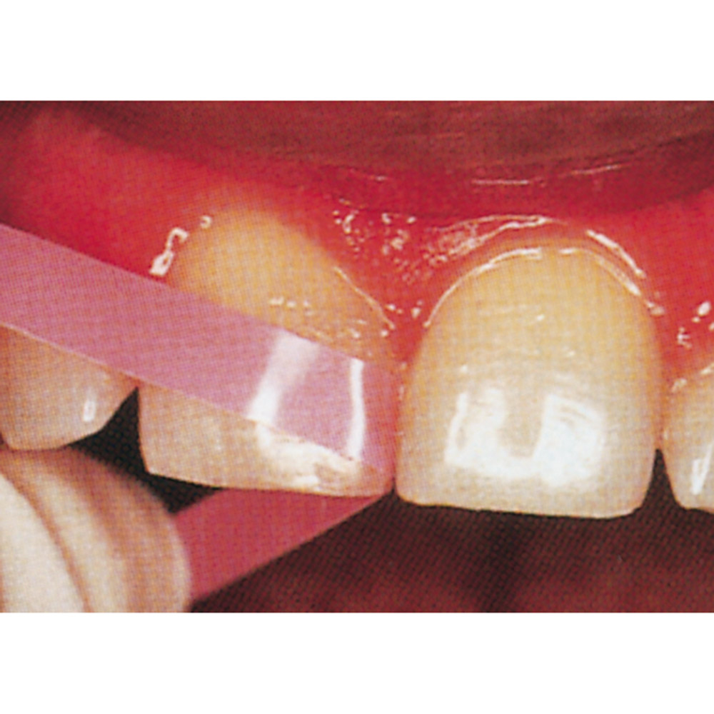 Super-Snap Mandrell FG, 6 Stück