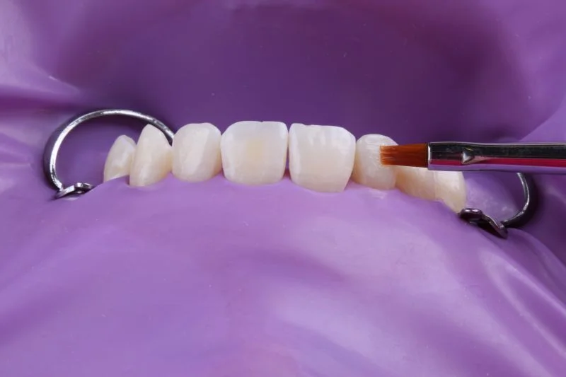 Optimierung der Form mit einem Pinsel.