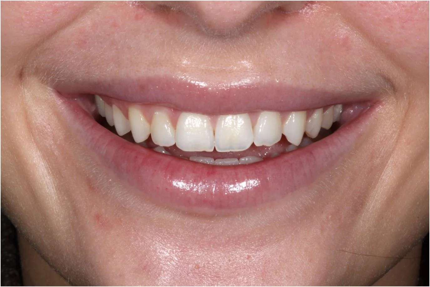 Ausgangssituation der Patientin.