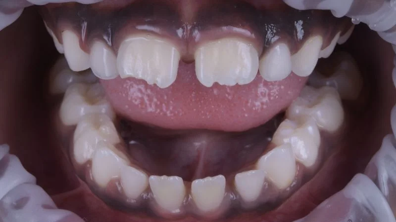 Ausgangssituation des Patienten