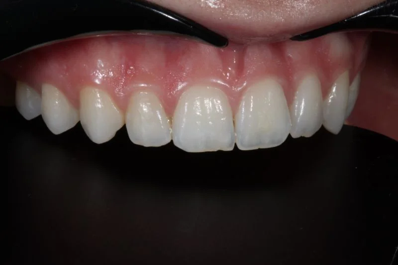 Anatomie des Zahnes 12.