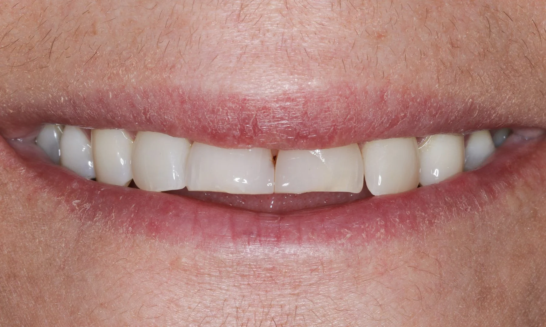 Ausgangssituation: Lächeln der Patientin.