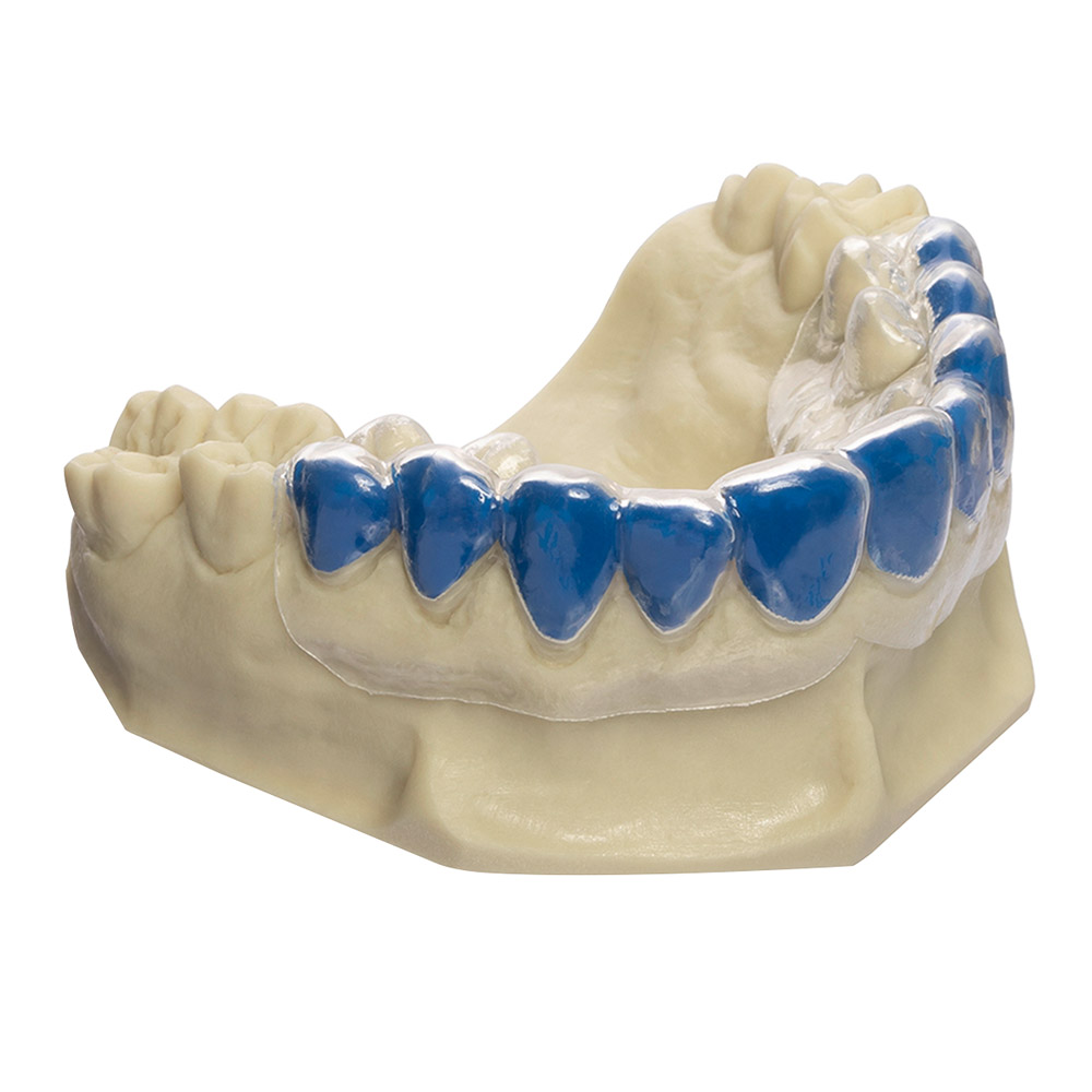 Bio Bleach soft 120 x 1,00 mm, 20 stk.