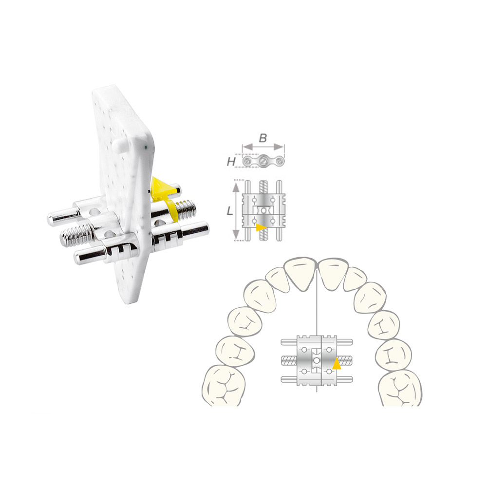 Dehnskrue Vector 200 maxi, 10 stk.