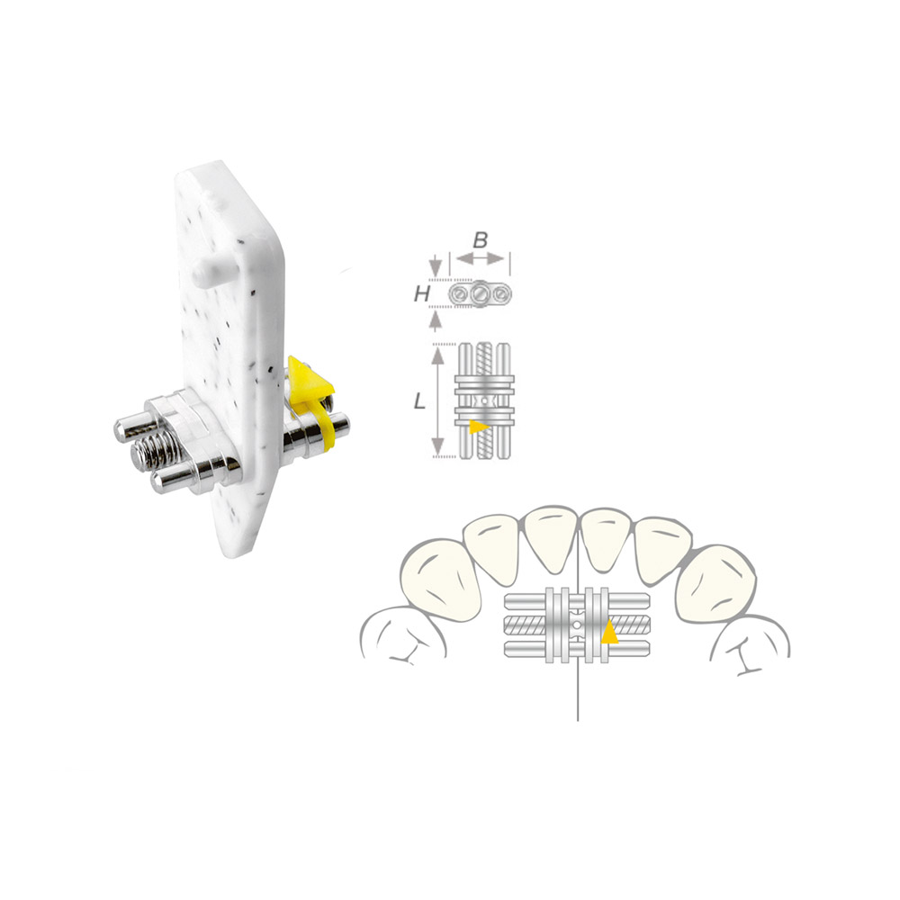 Rek-schroef Vector 100 mini, 10 stuks